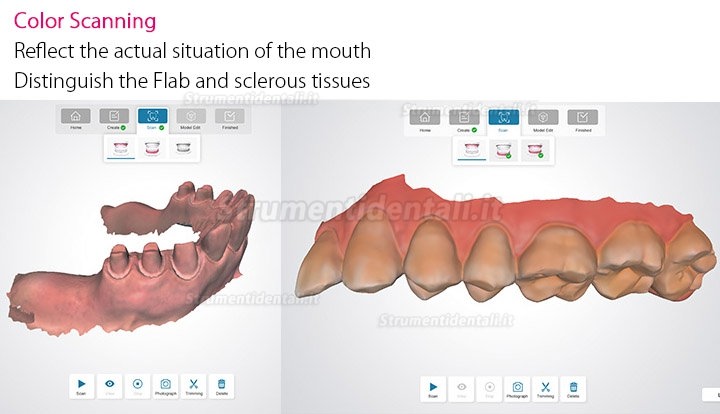 Fussen Scanner Intraorale Digitale 3D Dentale